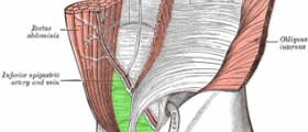 Pulled groin ligament