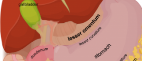 End stage of liver failure