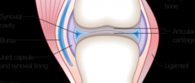 Chronic joint inflammation