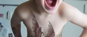 Costochondritis in children symptoms and treatment