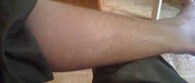 How to stop muscle twitching