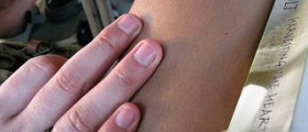 Blotchy skin on legs