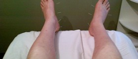 Acupuncture and infertility treatment go together