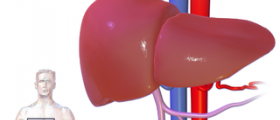 Chronic liver failure
