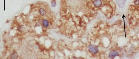 What is Luteinizing Hormone (LH)?