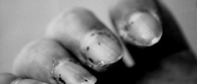 Fingernail pain and discomfort