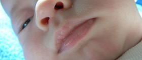 Treating nasal congestion in babies