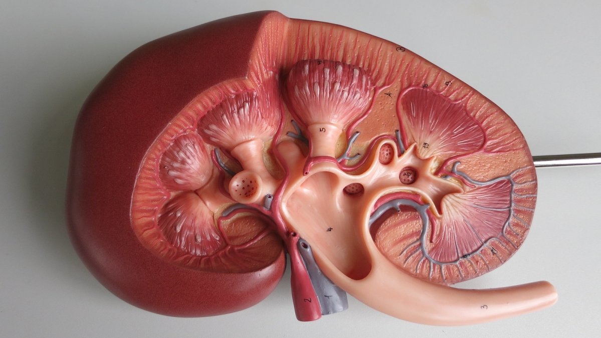 Urinary system disease: nephritic syndrome | Urinary Tract Issues