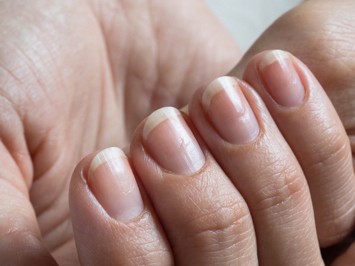 Medical Conditions That Can Affect Nail Bed Color - wide 1
