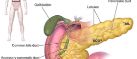 What is chronic pancreatitis
