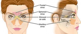 Fungal sinus infection causes