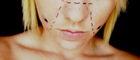 Cosmetic surgery - recovery