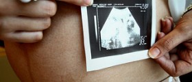 Stages of prenatal development