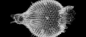 Disease caused by protozoa