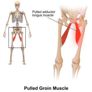 Pulled groin muscle symptoms | Musculoskeletal Issues articles | Body & Health Conditions center ...