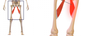 Pulled groin muscle symptoms