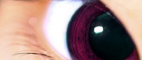 Dry eyelids allergy