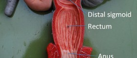 How to stop rectal bleeding