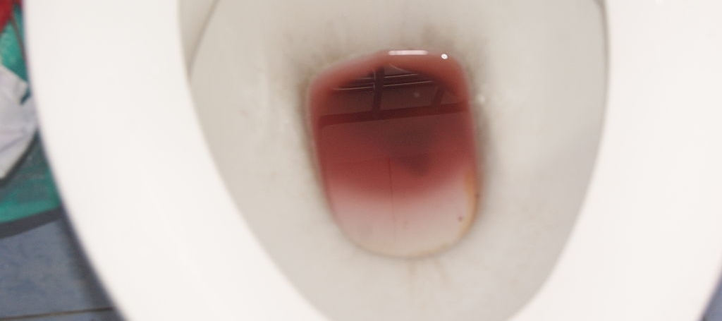 reddish-stool-in-toilet-bowl.jpg