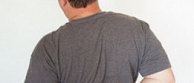 Therapy for sciatica