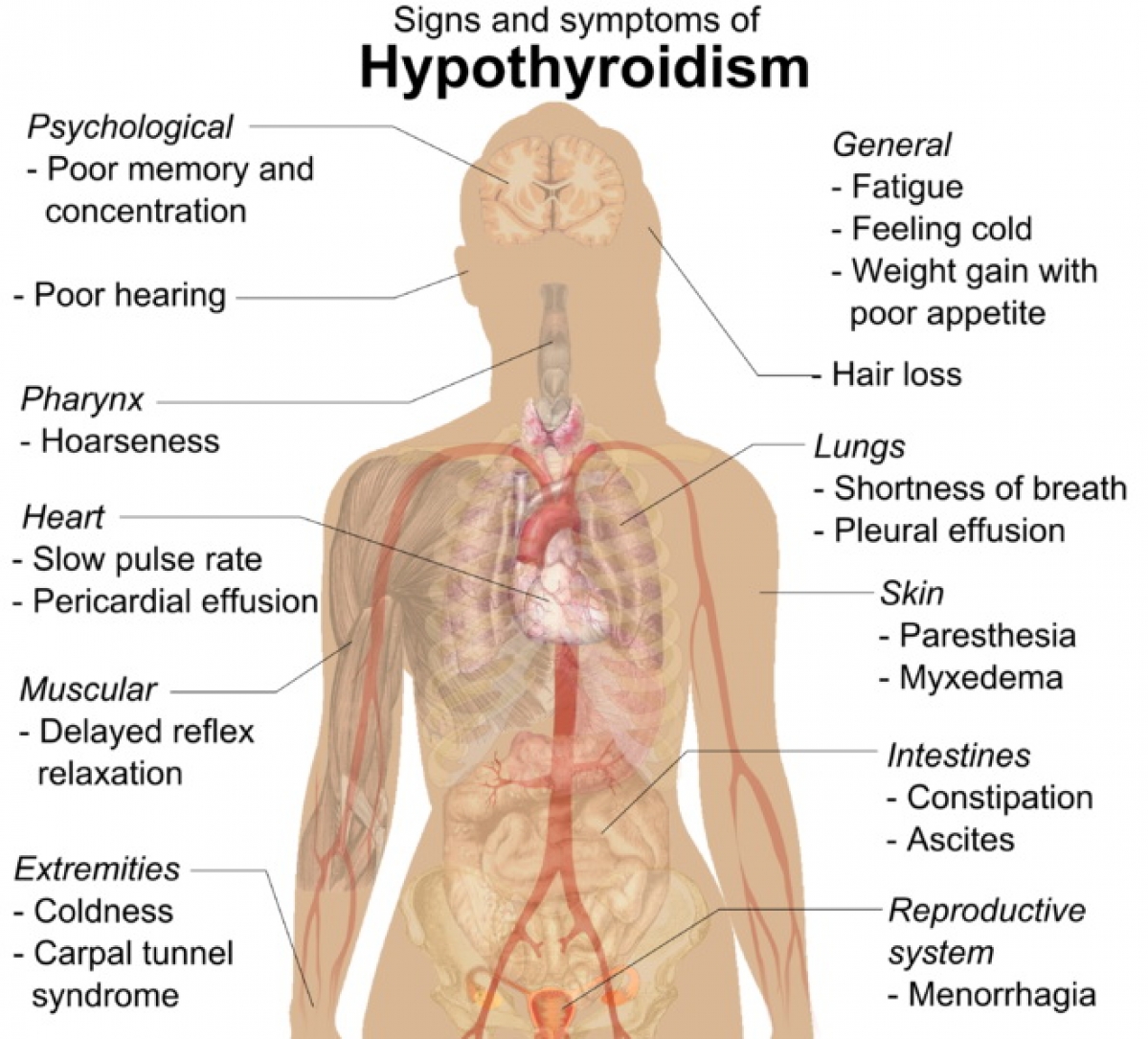 Does Hypothyroidism Cause Hair Loss On Legs