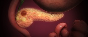 Pancreas problems - symptoms of pancreas problems