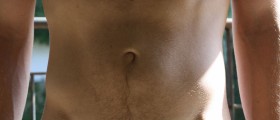 Facts about swollen abdomen
