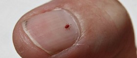 Skin parasites from hell