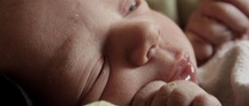 Retinopathy in newborns