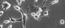 Smallest embryos most at risk of miscarriage