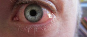 Sore eyes causes