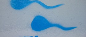 Sperm analysis - what you need to know about morphology