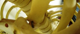 About lordosis exercises
