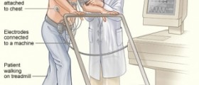 Nuclear stress test side effects