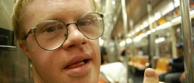 Social problems: Down syndrome social effects