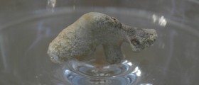 Kidney stones remedy - how to dissolve and pass any type of kidney stones