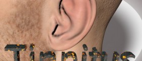 Prevention of tinnitus