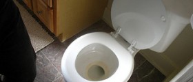 Painful bowel movements
