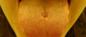 Red bumps on tongue