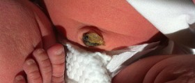 Caring for your baby's umbilical cord stump