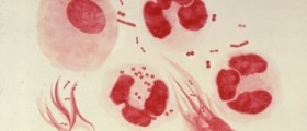 Urethritis symptoms, causes and treatment