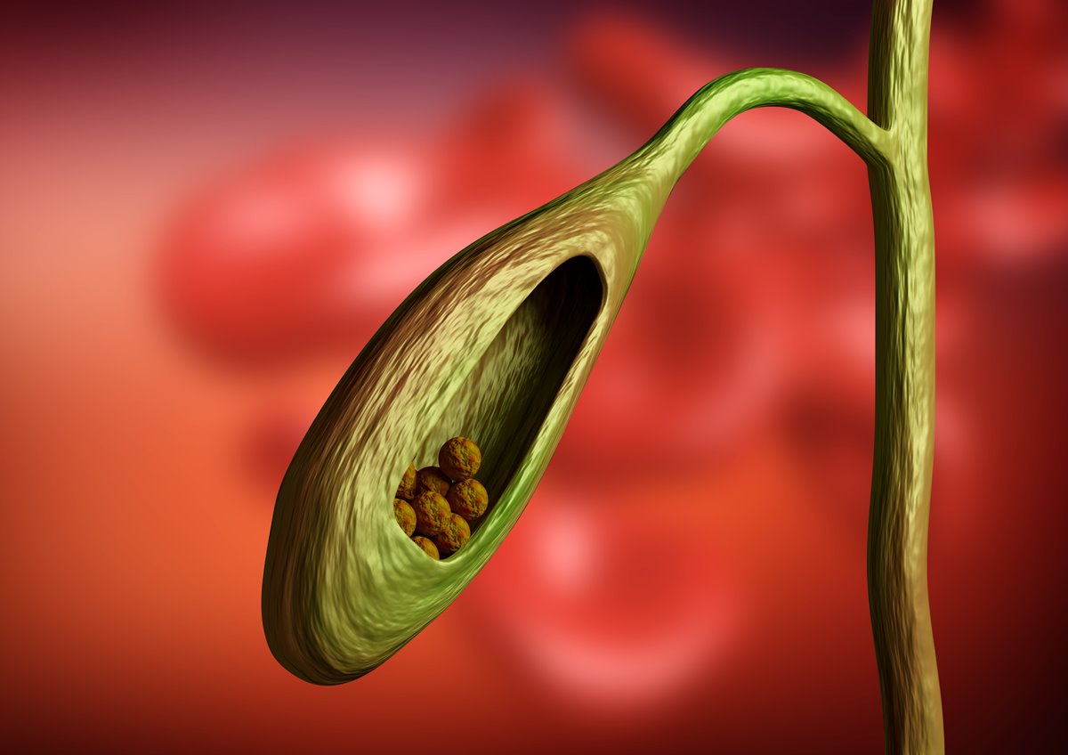 Weight Loss After Gallbladder Surgery Is Totally Normal