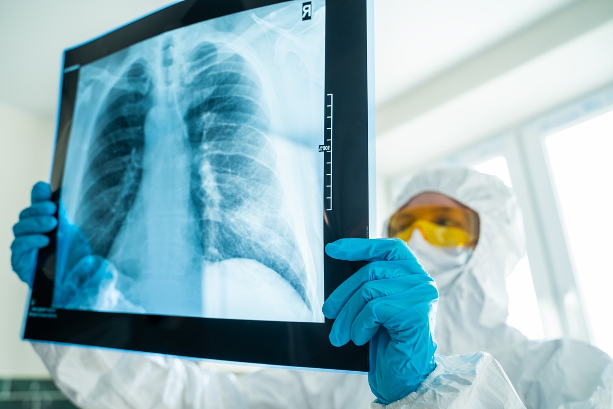 What Causes Sternum Pain And How Is It Treated? Musculoskeletal