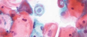 What to expect from a Pap smear