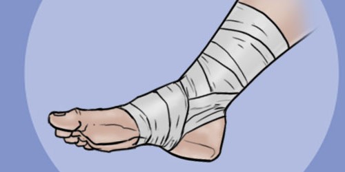 There's No Such Thing As Tendonitis