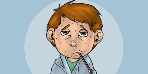 Childhood Rashes: Worry Or Not?