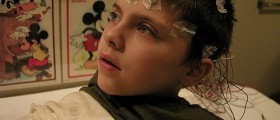 10 Frequently Asked Questions About Epilepsy