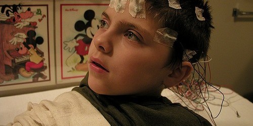 10 Frequently Asked Questions About Epilepsy