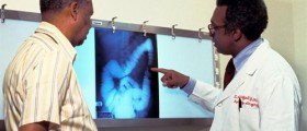 Is Your Stomach Safe From Ulcerative Colitis?