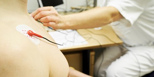 Risk Factors Of Dilated Cardiomyopathy